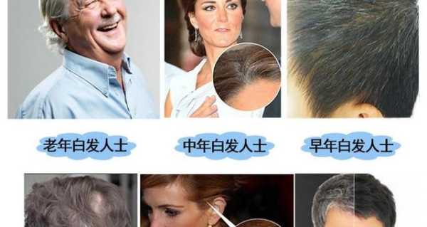 怎么治白头发（治疗白发最好的方法）
