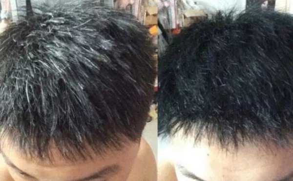 头发长白头发是什么原因（左边头发长白头发是什么原因）