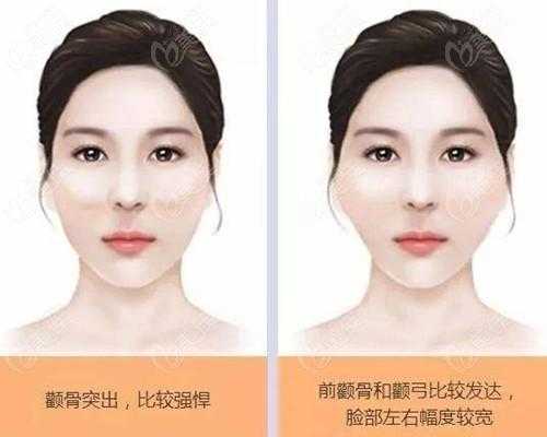 颧骨是什么（全脸颧骨最宽是什么脸）