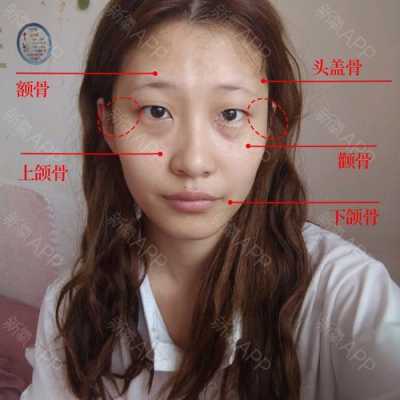 颧骨是什么（全脸颧骨最宽是什么脸）