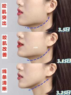 脸宽怎么瘦脸（颧骨宽的怎么瘦脸）