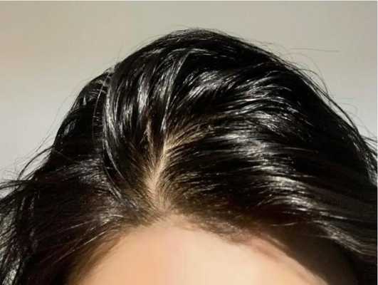 头发油了怎么办（头发油了怎么办不想洗）