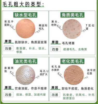 毛孔粗大什么原因（毛孔粗大怎么造成的）