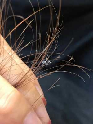 头发分叉是什么原因引起的,女性头发分叉什么原因