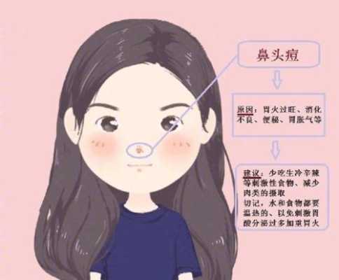 鼻梁长痘痘怎么回事（鼻子鼻梁长痘痘怎么回事）