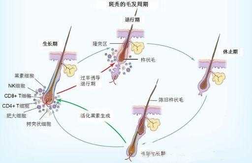 头发是怎么形成的（人的白头发是怎么形成的）