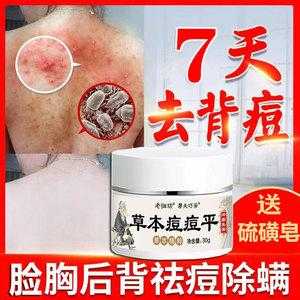 背部长痘用什么药,冬天背上长痘是什么原因