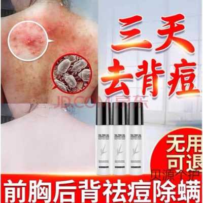 背部长痘用什么药,冬天背上长痘是什么原因