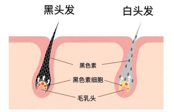 耳朵上面俩边长满了白发怎么办?是什么原因,吃什么治疗白头发最快