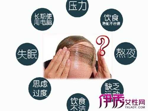 什么原因导致掉头发（什么原因导致掉头发严重）
