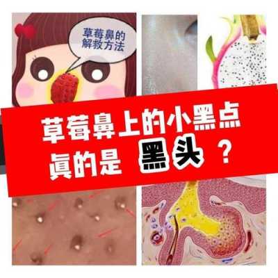 黑头怎么快速消除（黑头怎么快速消除小妙招）