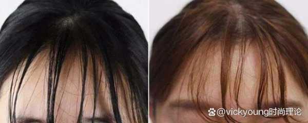 刘海一天就油是怎么回事,为什么刘海容易油但是其他地方还好