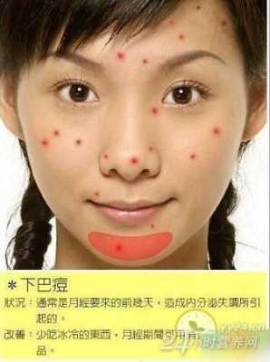 下巴长痘痘怎么处理（下巴长痘痘怎么调理）