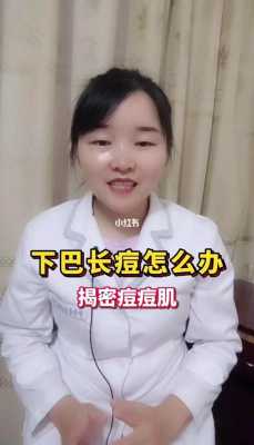 下巴长痘痘怎么处理（下巴长痘痘怎么调理）