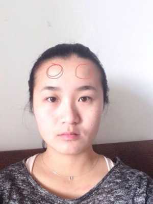 额头太凸怎么办（额头太凸怎么办图片）