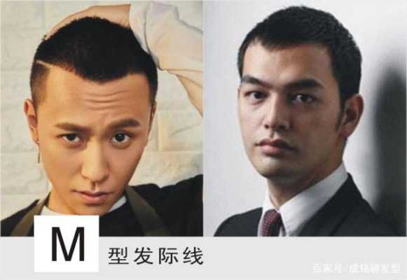 什么发际线最好看（m型发际线怎么分好看）