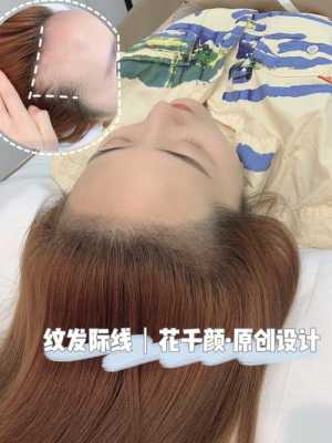 怎么拉低发际线（怎么拉低发际线?）