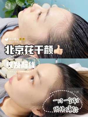 怎么拉低发际线（怎么拉低发际线?）