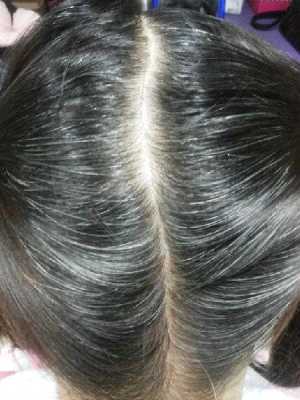 长白头发是什么原因造成的,30岁女性有白头发是为什么
