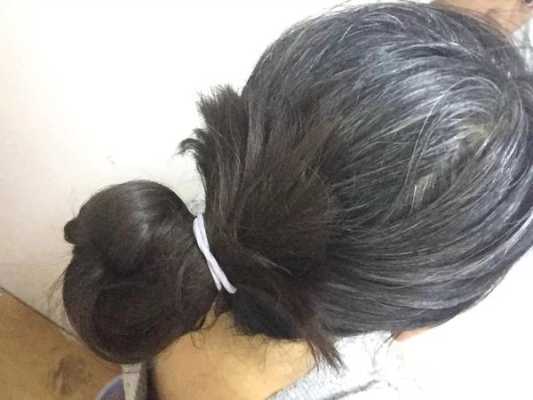 长白头发是什么原因造成的,30岁女性有白头发是为什么