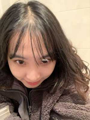 男生刘海长的太稀怎么办,女生前面头发越来越稀少怎么办