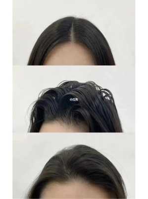 接完头发太贴头皮了怎么办,刚拉完头发太贴头皮了怎么办