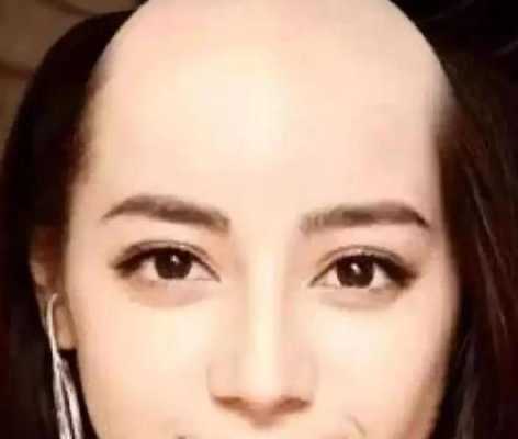明星为什么不脱发（明星为什么不脱发的原因）