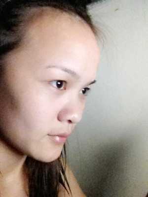 额头又高又凸怎么办（额头又高又凸怎么办女面相）