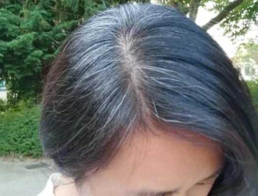 女人白头发是什么原因（女人白头发是什么原因引起的,怎样调理）