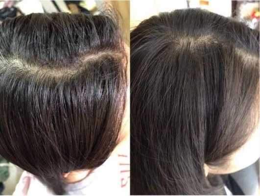女性头发稀疏怎么变浓密,小女孩头发少怎么变浓密用什么洗发水