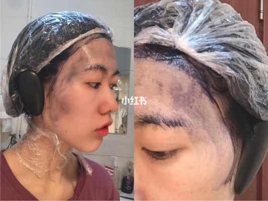染发膏弄到皮肤上怎么洗掉（染发膏弄到皮肤上怎么洗掉）