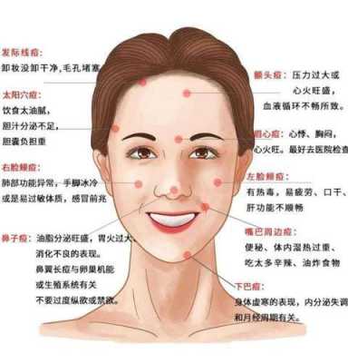 左脸起痘痘是什么原因（左脸起痘痘是什么原因怎么调理）