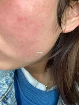 脸上皮肤粗糙是什么原因（为什么卸妆的时候感觉脸很粗糙）