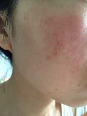 脸上皮肤粗糙是什么原因（为什么卸妆的时候感觉脸很粗糙）