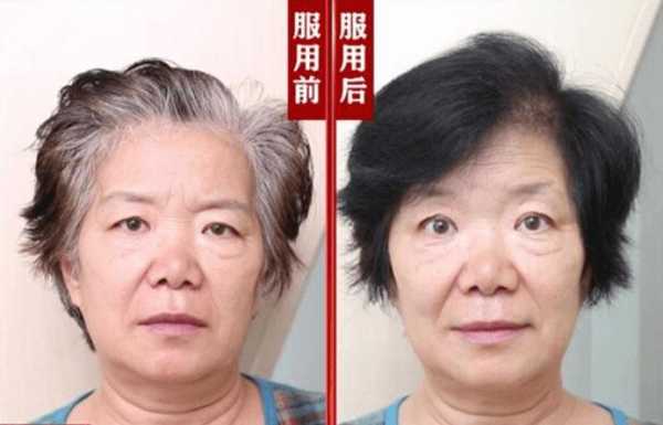 白发是怎么回事,白发怎么变黑发怎么调理