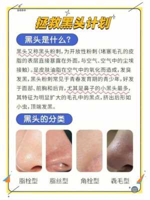 去黑头怎么去（怎么去黑头的方法）