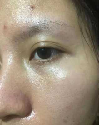 出油怎么办（出油的啥意思）