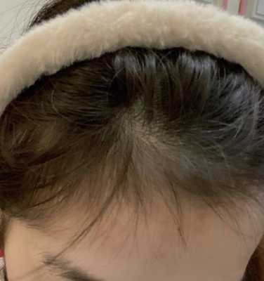 为什么长发梳了发尾容易断,头发经常断是什么原因导致