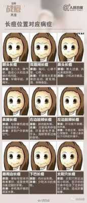 青春痘怎么（青春痘怎么）
