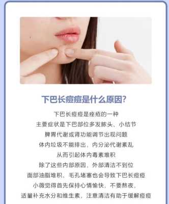 下颚两侧长痘的原因,下巴长痘怎么办才可以消除