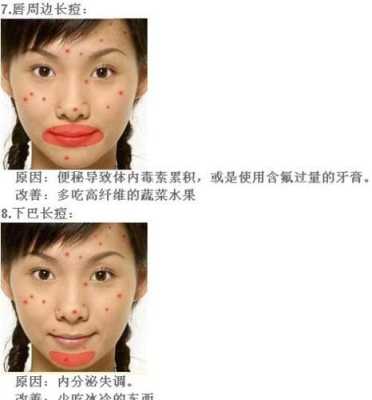 下颚两侧长痘的原因,下巴长痘怎么办才可以消除