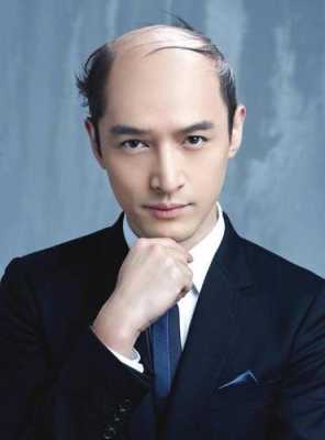 前面没头发叫什么（前面没头发叫什么发型）