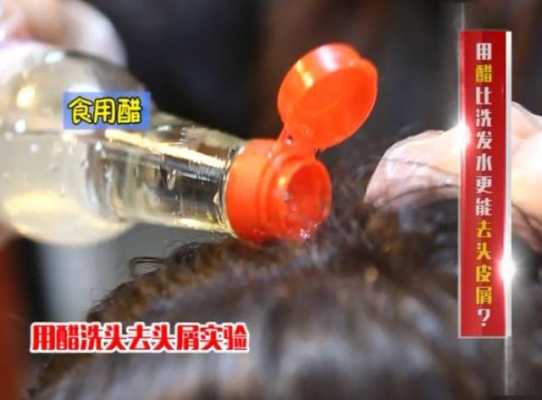 洗头加醋加盐有什么用,放盐洗头起到什么作用和功效