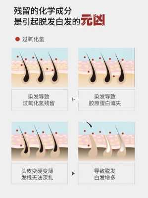 掉头发白发是什么原因引起的（掉头发白发是什么原因引起的）