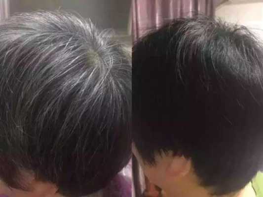 染白发怎么染（黑发染白发怎么染）
