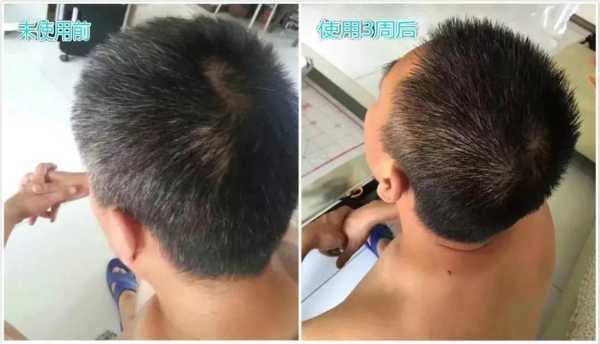 染白发怎么染（黑发染白发怎么染）