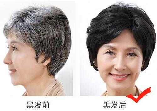 染白发怎么染（黑发染白发怎么染）