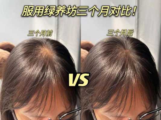 头发怎么养护（头发怎么养护才能又黑又亮）