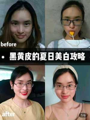 皮肤黑用什么（黑皮肤怎么能变白）