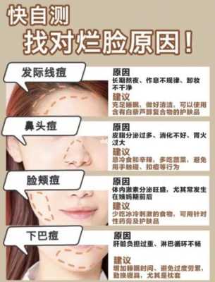 脸上长痘痘都有哪些原因,脸上长痘痘为什么不能喝牛奶